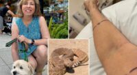 Grisly pictures show aftermath of rattlesnake bite â as victim speaks out